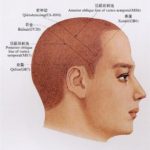 scalp acupuncture (3)