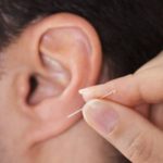 耳针治疗 (4)